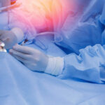 Eye surgery