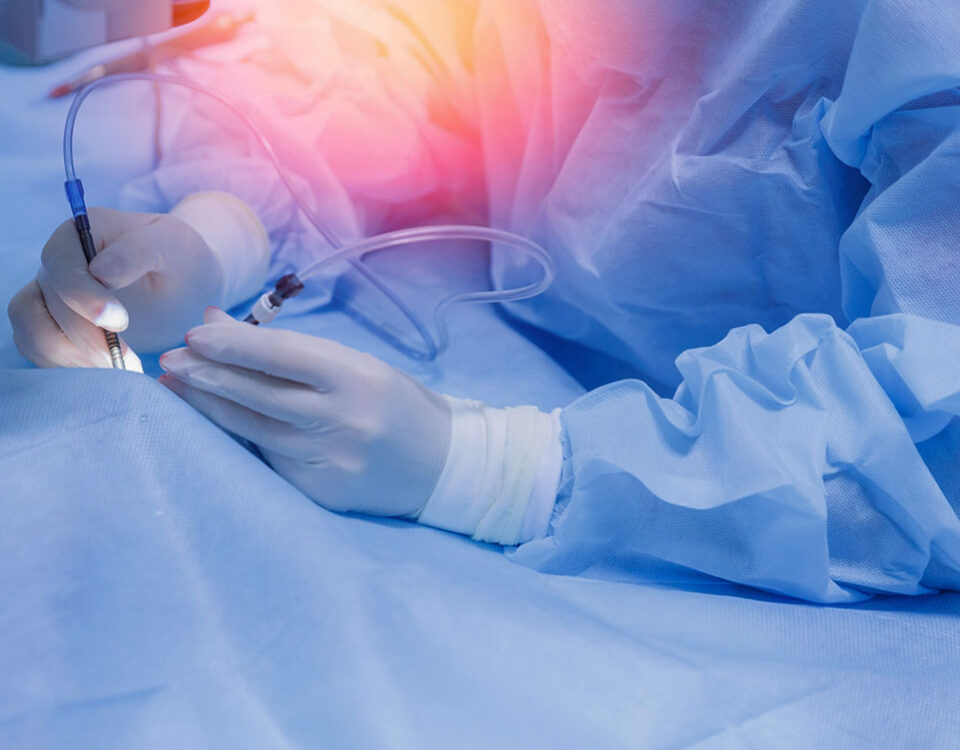 Eye surgery