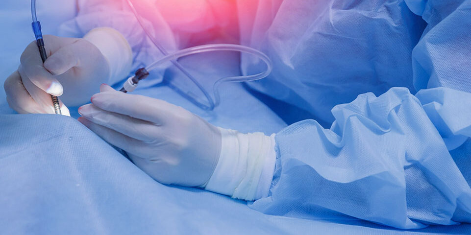 Eye surgery